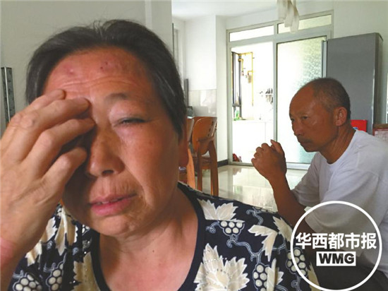 成都大妈在小诊所治皮炎 打完针后右眼失明